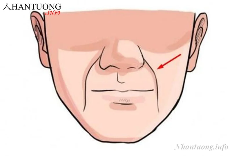 Vị trí đường pháp lệnh trên khuôn mặt Vị trí đường pháp lệnh trên khuôn mặt