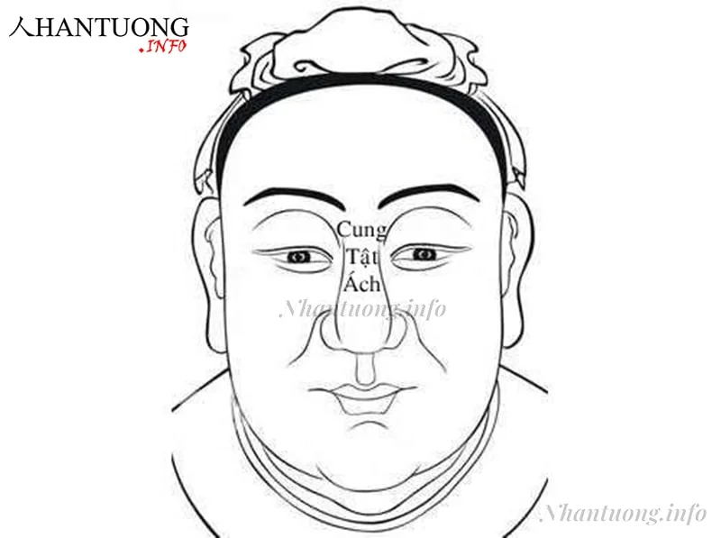 Cung tật ách Cung tật ách