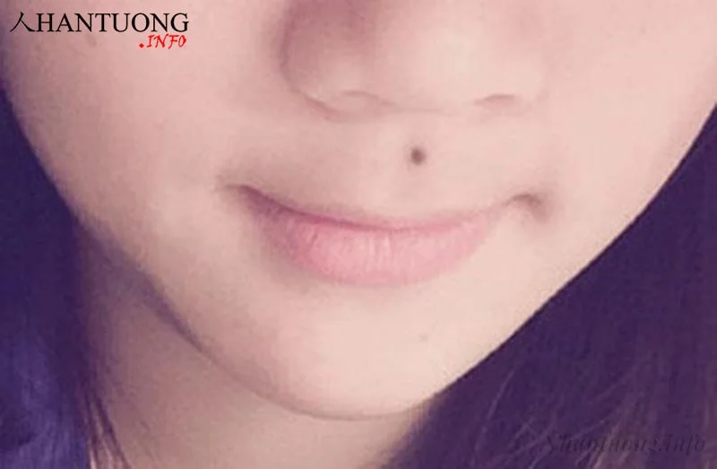 Phụ nữ có nốt ruồi ở nhân trung sẽ gặp khó khăn về đường con cái Phụ nữ có nốt ruồi ở nhân trung sẽ gặp khó khăn về đường con cái
