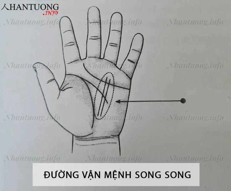 Đường vận mệnh song song Đường vận mệnh song song