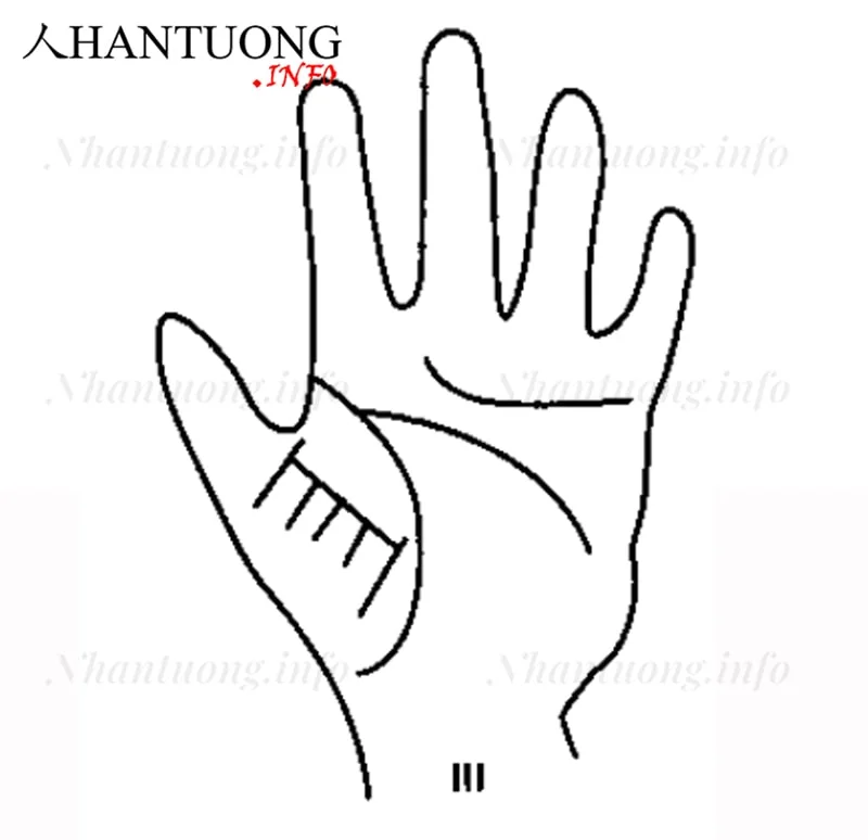 Có nhiều đường cắt ở phần trên gò Kịm tinh, ở khoảng chân ngón cái Có nhiều đường cắt ở phần trên gò Kịm tinh, ở khoảng chân ngón cái