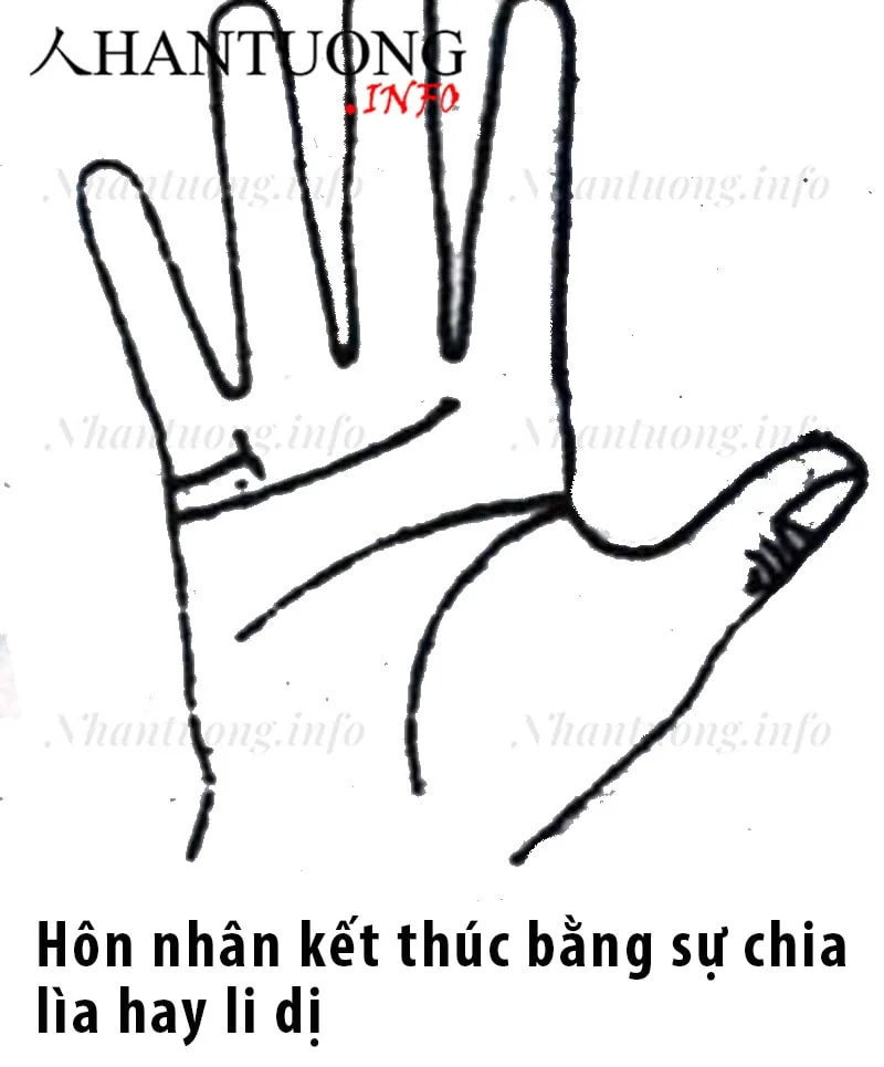 Đường Hôn nhân có chỉ nhỏ cắt ngang ở đầu Đường Hôn nhân có chỉ nhỏ cắt ngang ở đầu