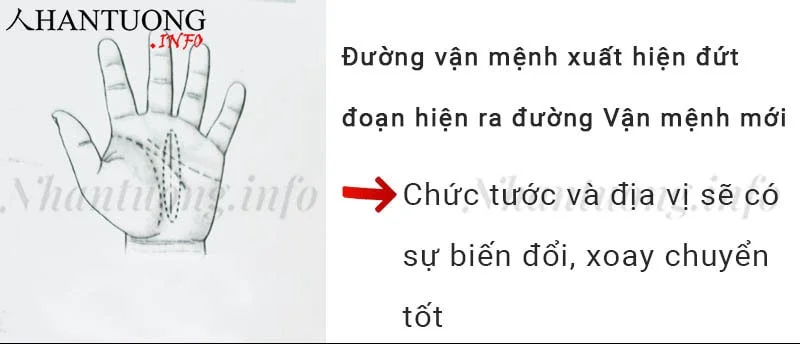Đường vận mệnh xuất hiện đứt đoạn hiện ra đường Vận mệnh mới Đường vận mệnh xuất hiện đứt đoạn hiện ra đường Vận mệnh mới