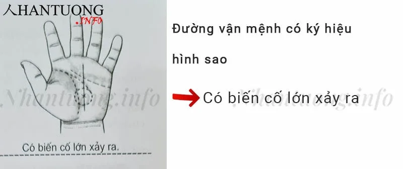 Đường vận mệnh có ký hiệu hình sao Đường vận mệnh có ký hiệu hình sao