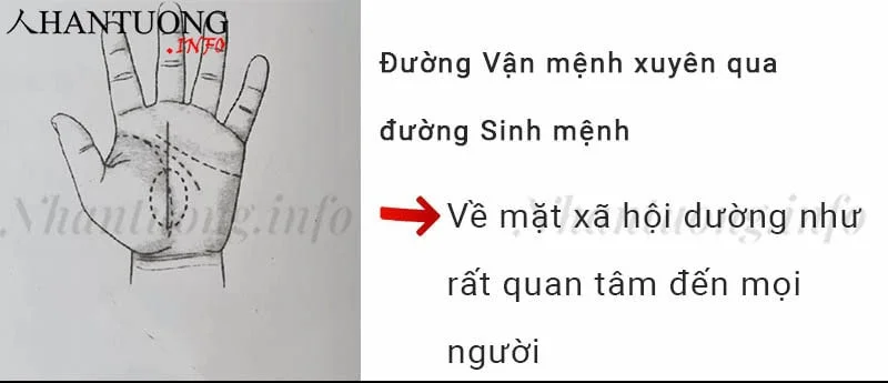 Đường Vận mệnh xuyên qua đường Sinh mệnh Đường Vận mệnh xuyên qua đường Sinh mệnh