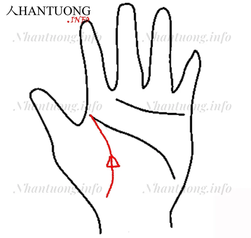 Đường sinh mệnh xuất hiện hình tam giác Đường sinh mệnh xuất hiện hình tam giác