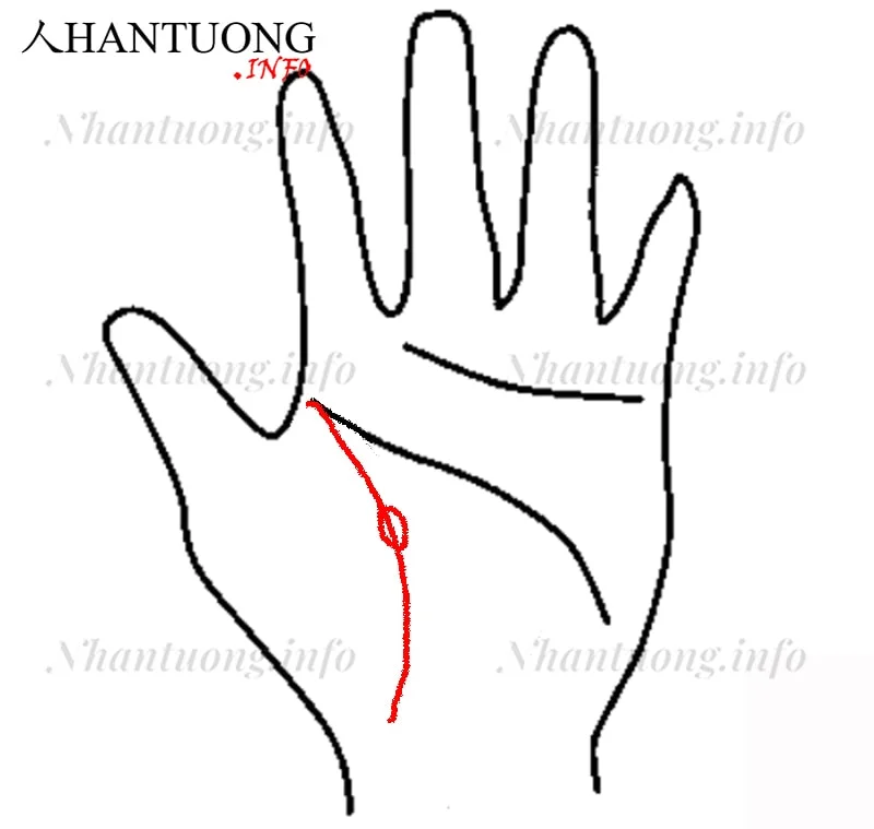 Đường sinh mệnh xuất hiện vân đảo Đường sinh mệnh xuất hiện vân đảo