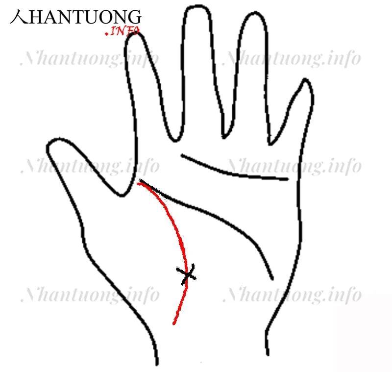 Đường sinh mệnh có dấu x, chữ thập Đường sinh mệnh có dấu x, chữ thập