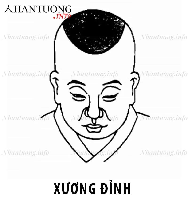 Đỉnh xương nhô lên bằng phẳng Đỉnh xương nhô lên bằng phẳng